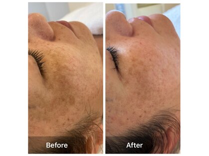 ミルフルール エステティックサロンの写真