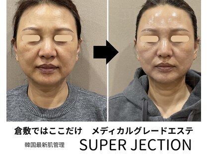 トータルビューティーサロンリア(Li'a)の写真