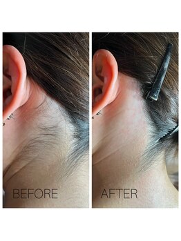 ココリ(CoCoRe)/うなじwax脱毛