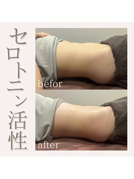 フラットベリー 恵比寿(Flat BELLY)/腸セラピー90分コース