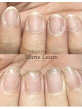 マリーロール 天王寺店(Marie Laure)/自爪育成/深爪矯正/ネイルケア