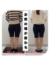スタイルラボ高松/産後骨盤矯正の変化♪