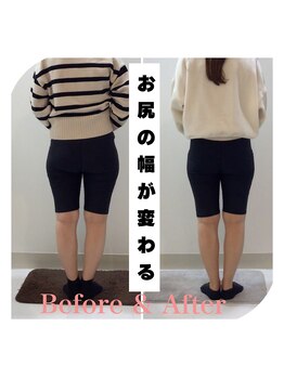 スタイルラボ高松/産後骨盤矯正の変化♪