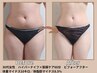 【イベント前！短期集中】◆超むくみケア!オーダーメイド痩身&小顔90分¥11000