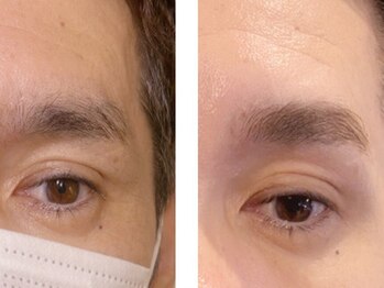 【メンズ＆レディース眉毛サロン】浅草アイブロウの写真/＜SNSでも話題のハリウッドブロウリフト！＞印象を左右する“眉毛”は理想の美眉で第一印象UP♪男女歓迎◎