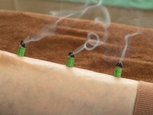 アガペー鍼灸の雰囲気(国内産のもぐさで熱くない、気持ちいいお灸)