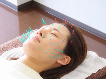 あいあい整骨院 津山院の写真/【津山希少☆】当店人気No.1美容鍼◎美肌/小顔/エイジングケア/リフトアップも叶う♪『鍼』初体験歓迎!