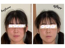 鍼灸庵利央/きれいなひとは鍼がお好き