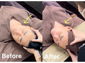 グリズコルギ(Guri's korugi)/コルギ施術効果☆首の可動域!