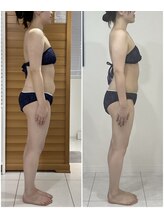 エゴ(EGO)/20代半ば　163.5cm 3.7キロ減