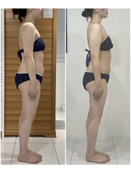 エゴ(EGO)/20代半ば 163.5cm 3.7キロ減