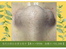 ビービー(BB)の雰囲気(リピ確定!こびり付いた黒ずみ・角栓を浮き出す【鼻スパ¥550-】)