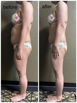 チュラ/ハイパーナイフ/所沢/痩身エステ