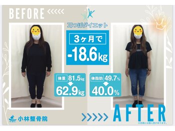 小林整骨院 天六の写真/15-20kg本気で痩せたい方へ!体質に合わせたダイエットで無理なく理想の身体を目指せる専門店