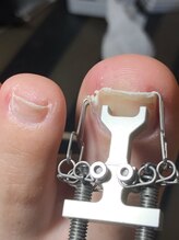 トゥーネイル(02nail)/