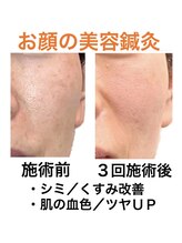 鍼灸サロンオランジュ 高槻富田院/