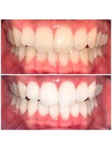 ライトビューティー 池袋店(LightBeauty)/症例写真