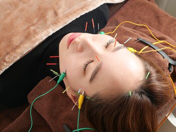 ベルルーナ(Belle-Lune)/美容鍼灸