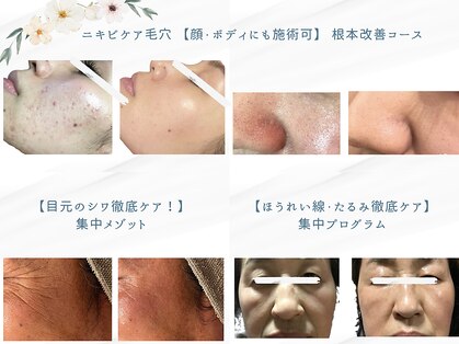 ホリスティックサロン ヘルバ(Holistic salon Herba)の写真
