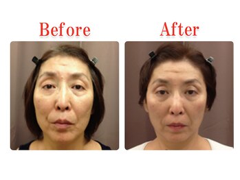 ビューティースリム タニダ/頭蓋骨&小顔&顎関節矯正