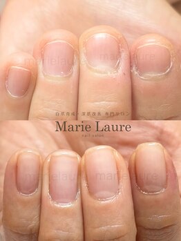 マリーロール 淀屋橋本店(Marie Laure)/自爪育成/深爪矯正/ネイルケア