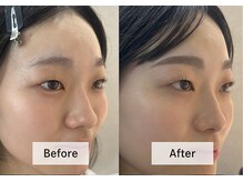 アンドミー 月島店(and me.)/30代/眉WAX&顔タイプ診断