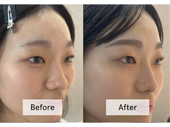 アンドミー 月島店(and me.)/30代/眉WAX&顔タイプ診断