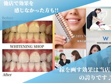 ホワイトニングショップ 静岡葵区店