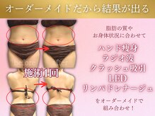 おにぎり(ONIGIRI)