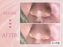 クリアラボ 池袋2nd(Clear Lab)/韓国肌管理&毛穴洗浄専門店