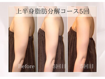 ミア(miiia)の写真