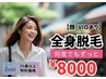 【35歳以上】レディース脱毛　全身脱毛（顔・VIOあり）￥8000