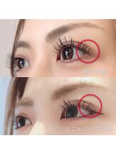 イーストアッカ アイラッシュ(East AkkA eyelash)/下向きまつ毛アップ