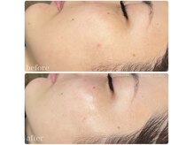 ちらちゅら/クリスティーナ【ビオフィート】