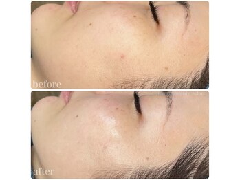 ちらちゅら/クリスティーナ【ビオフィート】