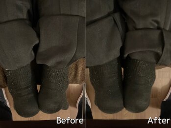 チアーライフ整体/骨盤矯正の効果/マッサージ/小顔