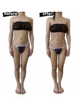 ミイン(miin)/全身コース（20代）