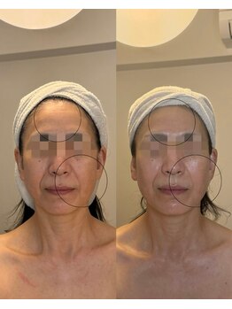 フロル(FLOR)/FLOR【根本改善専門店】