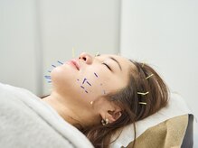 ユアン(Yuan)の雰囲気（むくみ、頭のコリを解消！[向ヶ丘遊園/登戸/鍼灸]）