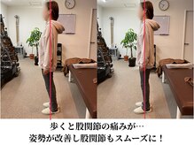 みつばち鍼灸整骨院/バキバキしない矯正です