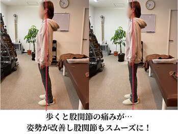 みつばち鍼灸整骨院/バキバキしない矯正です