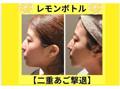 アン 銀座(ann)の写真