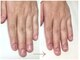 アウェイク ネイル(Awake Nail)の写真/ネイルサロンが初めての方、爪を見せることに不安がある方もご安心ください。