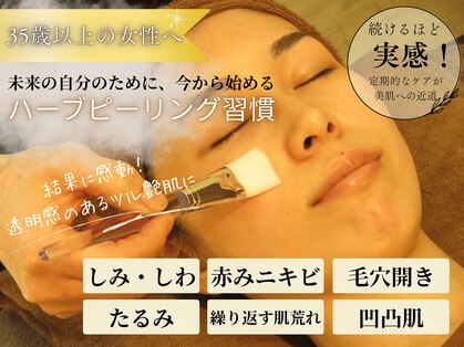 ウリア(ULIA)の写真