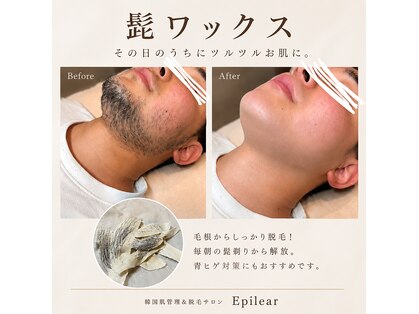 エピリア(Epilear)の写真