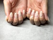 アマネラ(Amanera)/