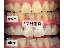 ガーディー(GaDaY)/お得な回数券◎before→after