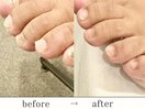 フットケア★ビフォーアフター★