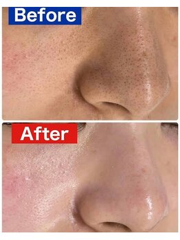 スリリアン 銀座/★お客さまビフォーアフター★