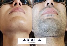 アカラ 読谷店(AKALA)